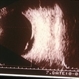 Central Serous Chorioretinopathy 5